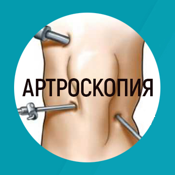 Артроскопия суставов в клинике "Говорово" Артроскопия суставов в клинике "Говорово"