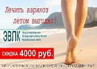 Лечить варикоз летом выгодно! Лечить варикоз летом выгодно!